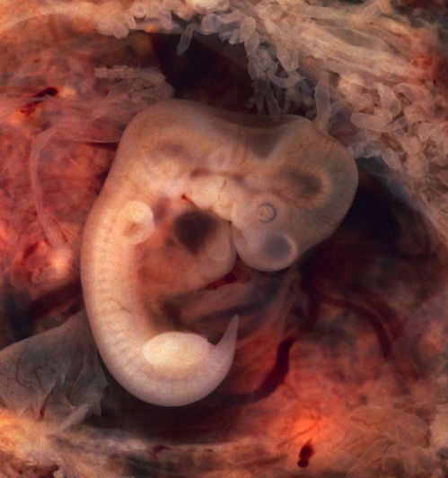 Embrión humano a las 7 semanas (Wikimedia)